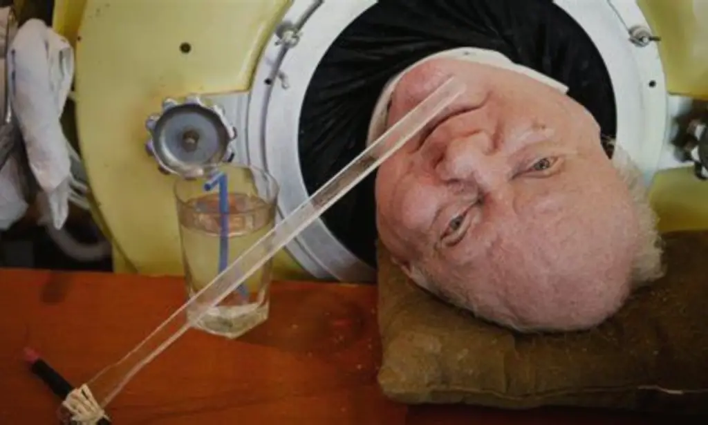 78-year-old Paul Alexander iron lung man, has died. 